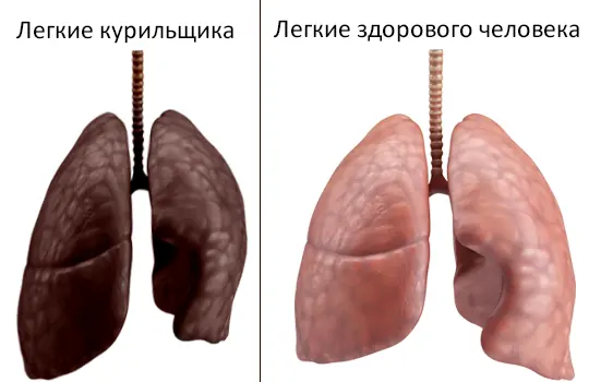 Легкие курильщика и здорового legkiye lurilschika